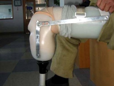 支架類穿戴